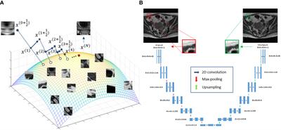 MR image reconstruction from undersampled data for image-guided radiation therapy using a patient-specific deep manifold image prior